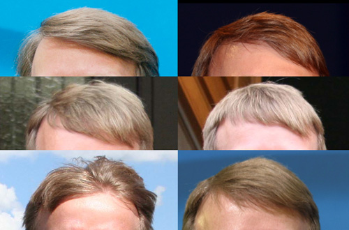 CDU rückt nach rechts Dreimal Pofalla